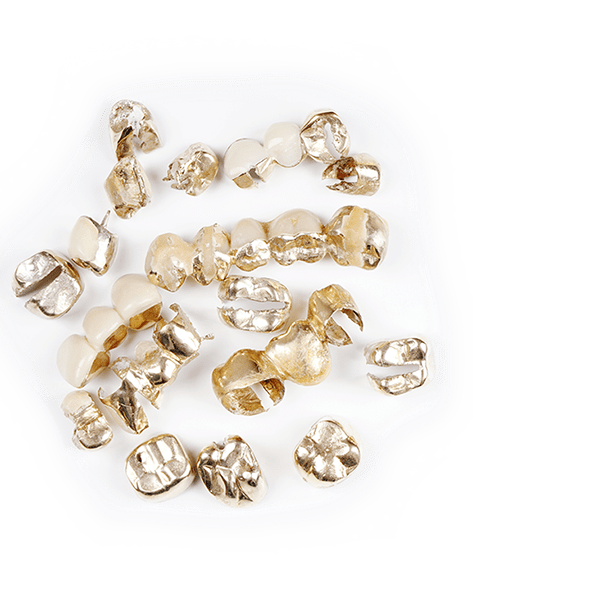 Zahngold-Ankauf-München-Pasing